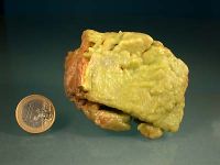 Photo 1/4 : Polysphaerite (Pyromorphite)